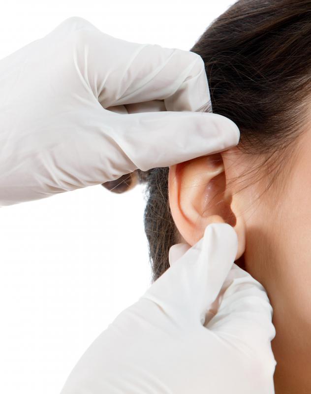 Otoplastie Turcia
